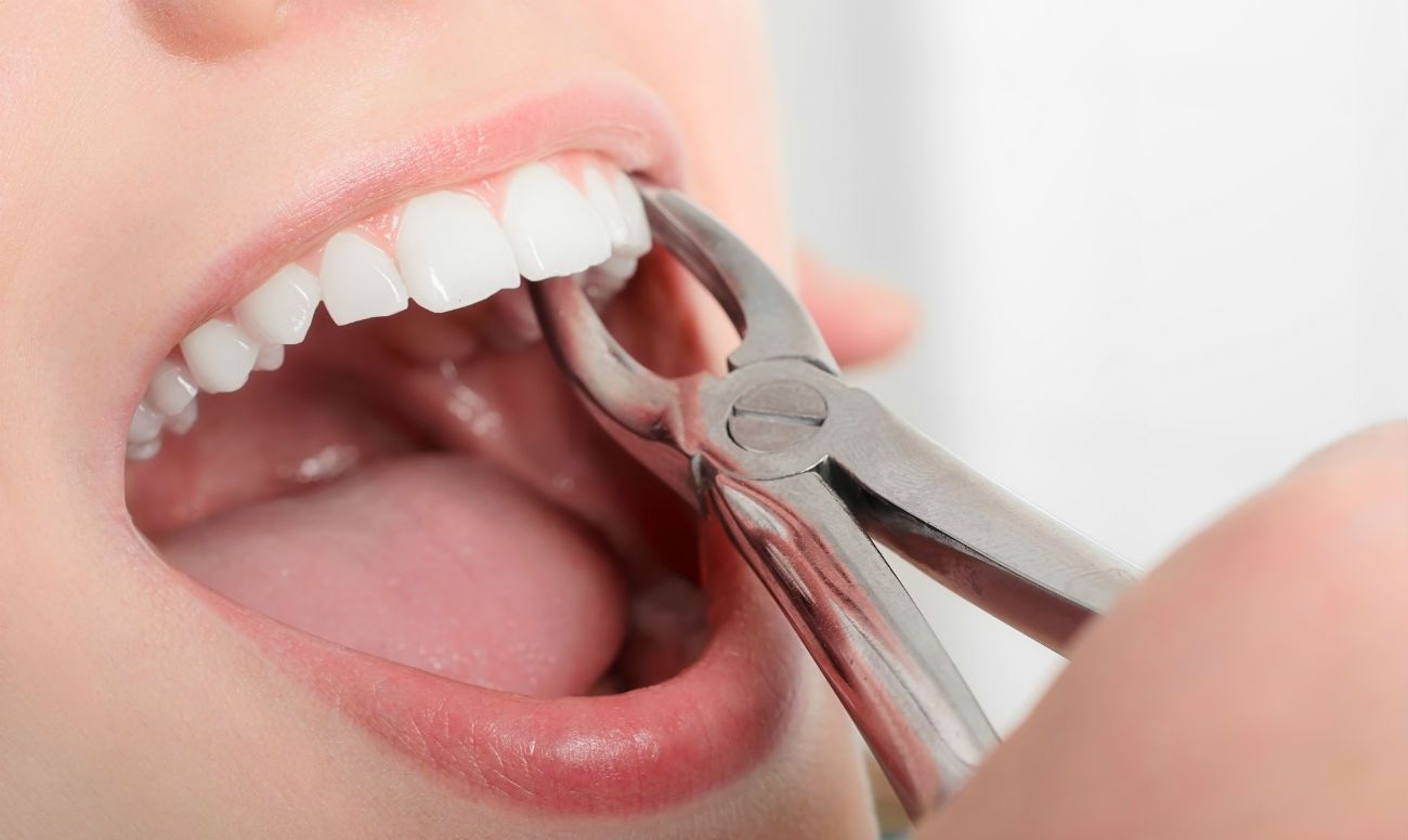 удалить зуб в томске бесплатно